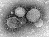            (MERS-CoV)